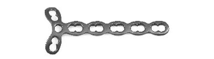 Y-подібна блокуюча пластина для фаланги пальця Jinlu